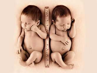 盤點新生寶寶常見的5種胎記
