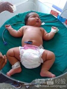 哪些原因影響新生兒出生體重？