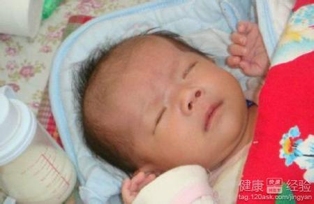 自然分娩的新生兒會得先天性淚囊炎嗎