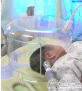 早產新生兒出生時吸入性缺氧能治好嗎
