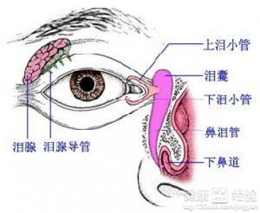 新生兒淚管閉塞該怎麼治療