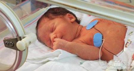 新生兒吸氧後眼內有一白色影象怎麼一回事