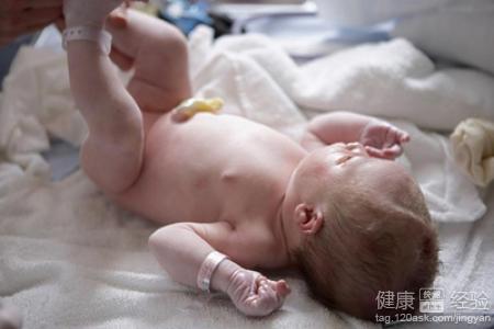 剛出生的寶寶臍帶的護理