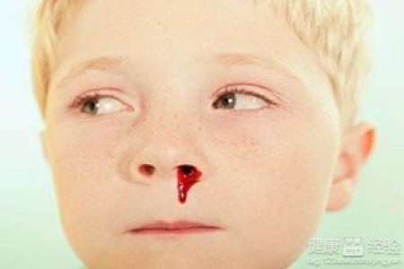 寶寶鼻子流鼻血怎麼辦？