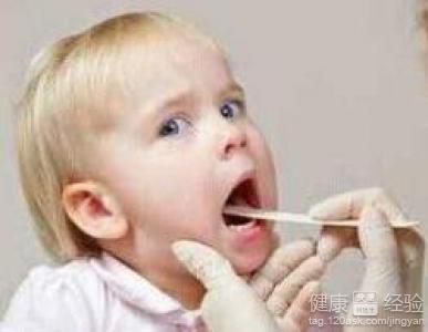 寶寶喉嚨有疱疹能吃水果嗎