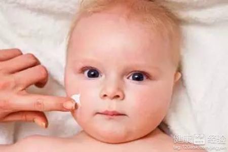 寶寶濕疹藥膏有哪些