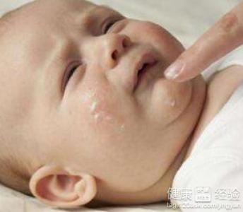 寶寶濕疹飲食怎麼調理
