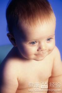 寶寶腦積水的症狀有哪些
