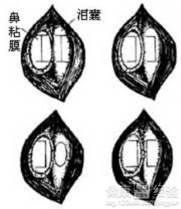 第2步