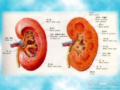 嬰兒雙腎積水怎麼辦