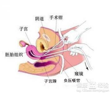 第2步