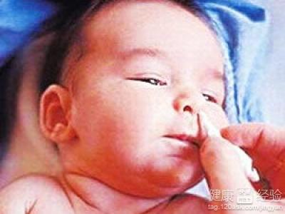 嬰兒鼻炎怎麼治療