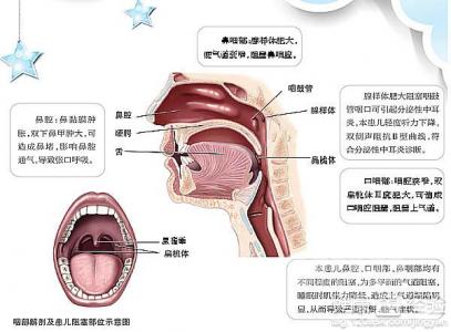 嬰兒打鼾，是什麼原因