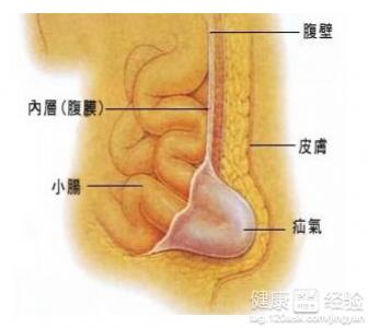 第1步