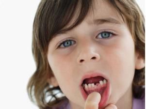 孩子牙齒不齊多是後天因素造成